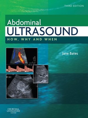 ultrasonography books